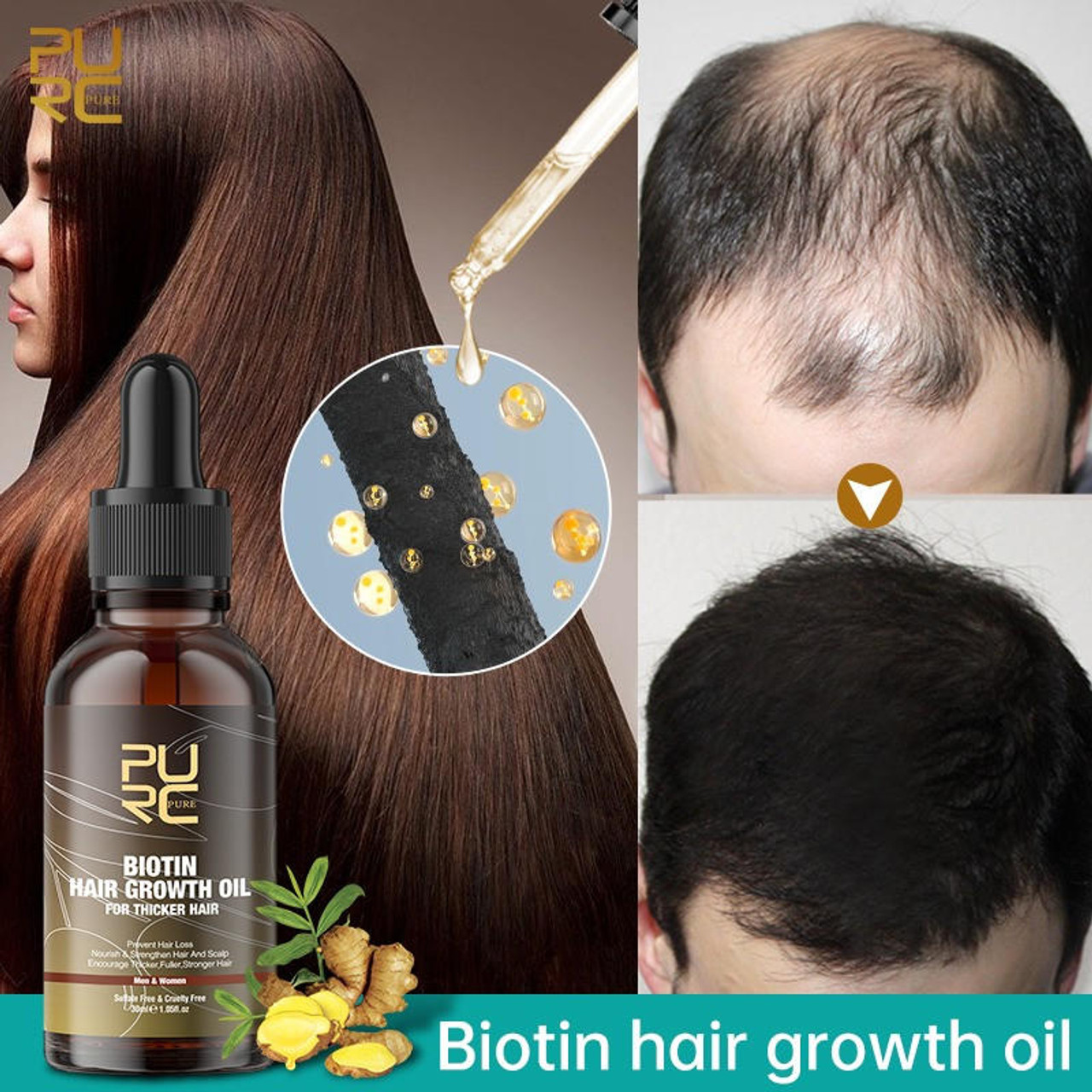 Biotin hair growth oil bottle on a white surface, promoting fuller, healthier hair with the benefits of biotin for stronger and thicker hair growth