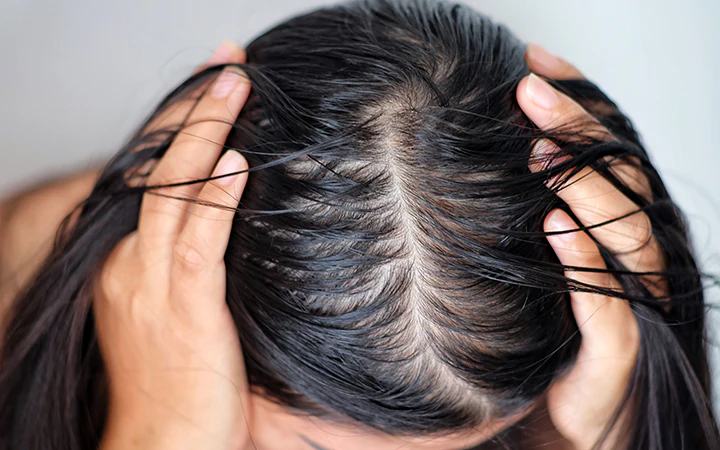 Why Does My Hair Get Oily So Fast? Causes and Easy Fixes